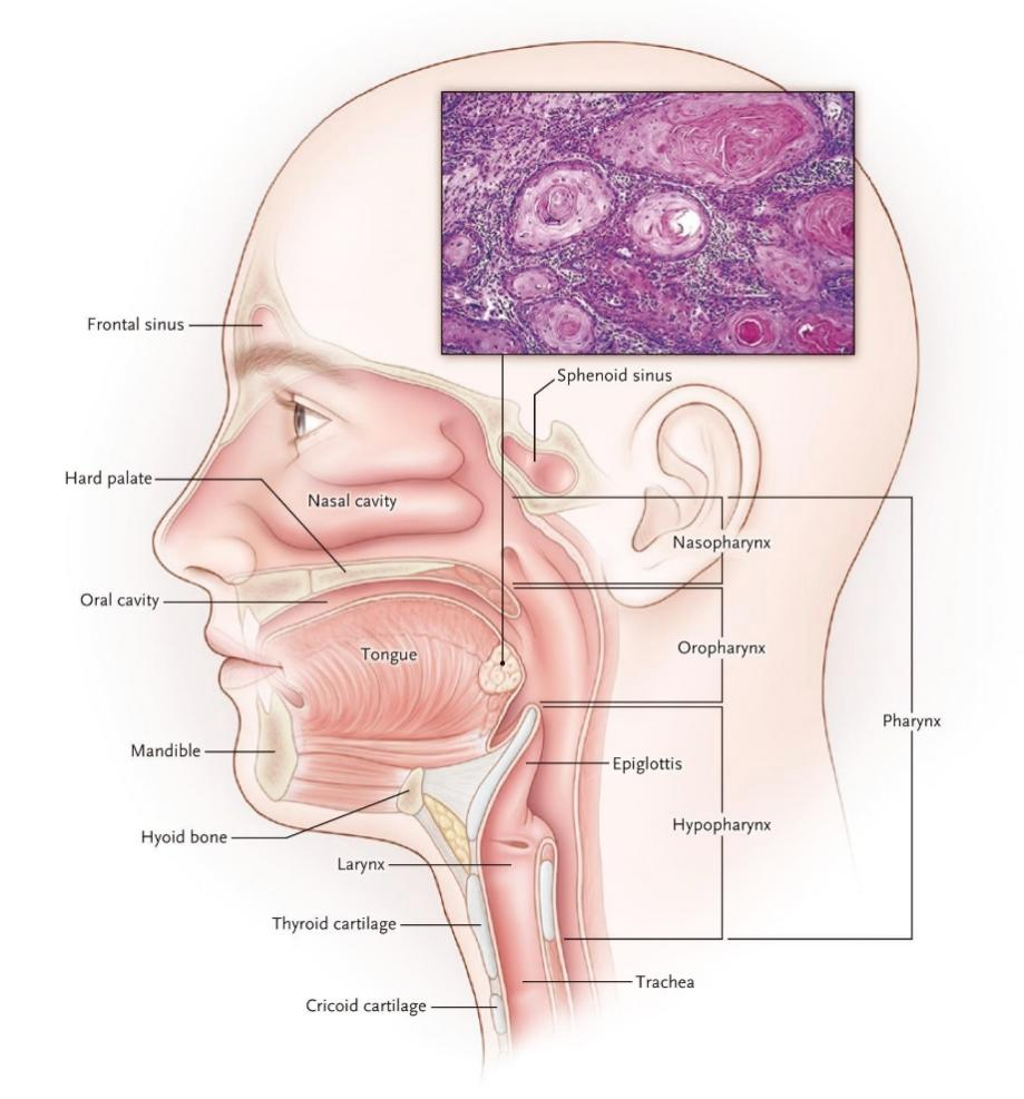 头颈癌：现状、诊疗与未来展望