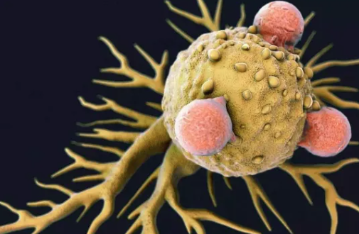 病理报告别只看"恶性！这 5 个词，才是抗癌关键