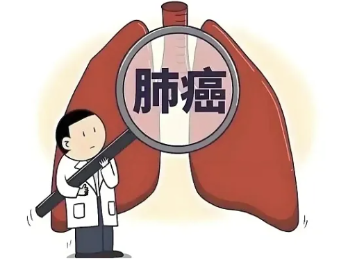 肺癌&ne;绝症！查出肺癌别认命，有人晚期仍活过五年！