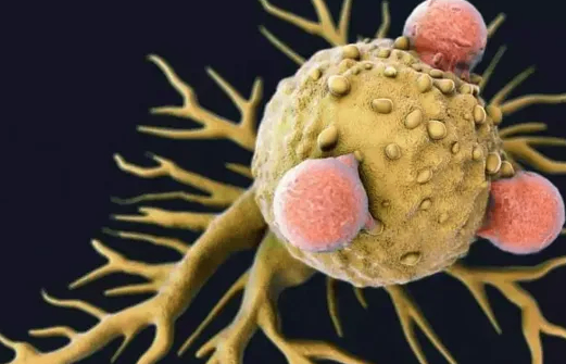 如何让癌细胞停止生长？做好这5点，可能多活20年！