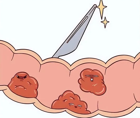 同样是胃癌，有人活 20 年有人却撑不过 1 年？答案藏在这 3 件事里