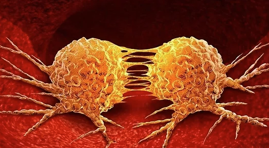 手术切干净了，为啥还会复发？这 5 种癌要格外当心