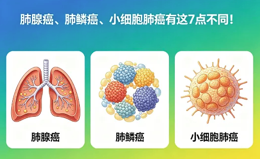 同样是肺癌，为什么有人能活十年，有人撑不过半年？
