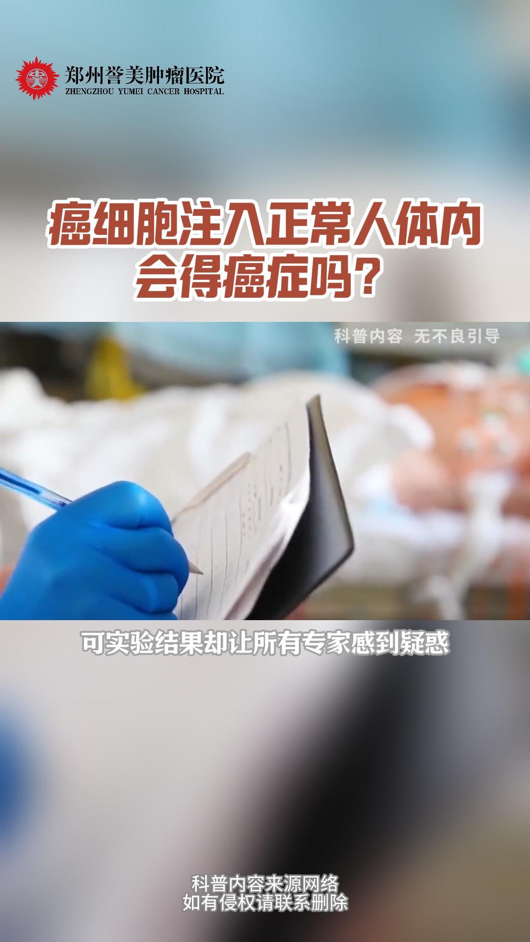 第三十五期 癌细胞注入正常人体内会得癌症吗