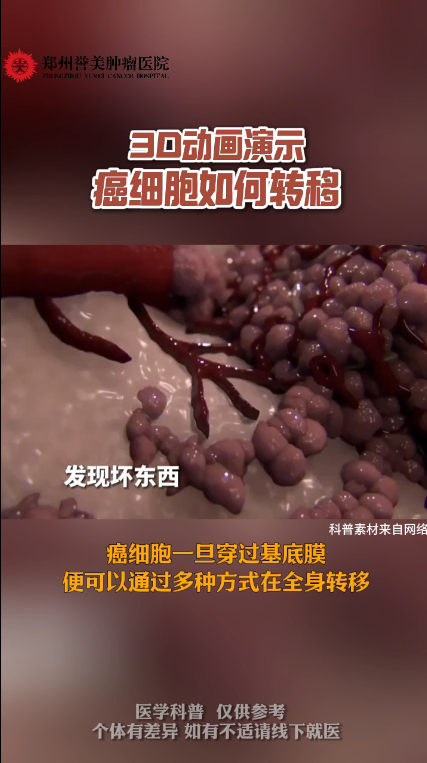 第三十六期 癌细胞如何转移