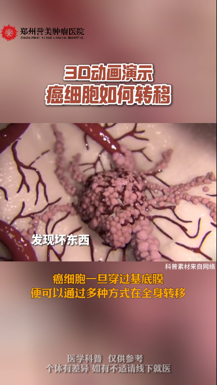 第三十九期 癌细胞如何转移