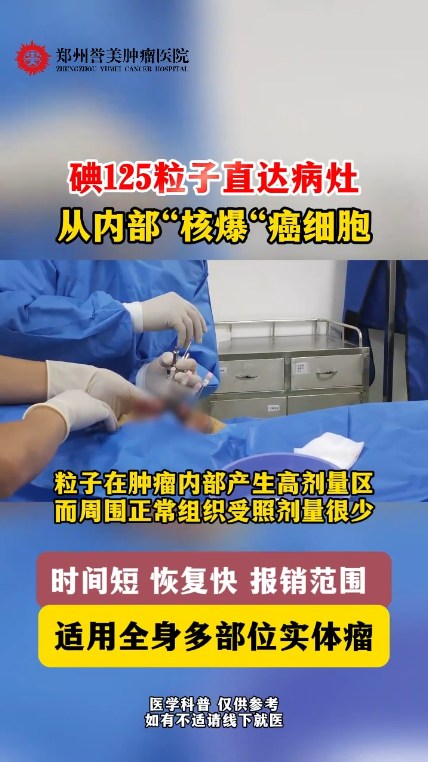 第四十期 碘125粒子直达病灶 从内部&ldquo;核爆&rdquo;癌细胞