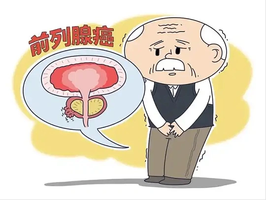 别把骨痛当腰突！这个中老年男性的&ldquo;隐形杀手&rdquo;，70%发现就是晚期
